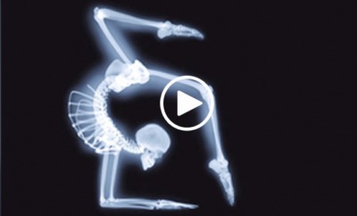 x ray yoga