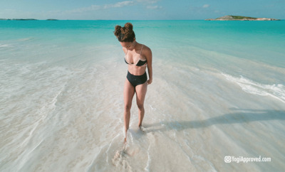 natural sunburn remedies featured